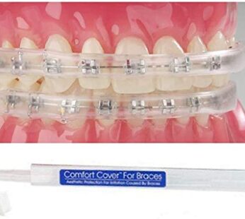 Sonic Dental – Comfort Guard/Lip Shield/Mouth Guard – for Braces – Orthodontic – Dental